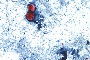 How Schools Should Manage the Cyclospora Outbreak